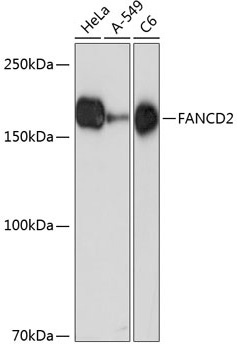 FANCD2 Rabbit Monoclonal Antibody