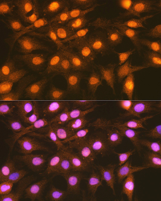 FANCD2 Rabbit Polyclonal Antibody - Image 2