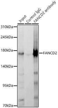 FANCD2 Rabbit Polyclonal Antibody - Image 3
