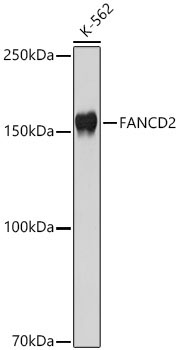 FANCD2 Rabbit Polyclonal Antibody