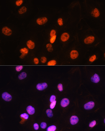 FANCD2 Rabbit Polyclonal Antibody - Image 2