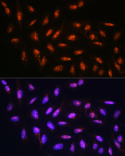 FANCD2 Rabbit Polyclonal Antibody - Image 3