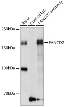 FANCD2 Rabbit Polyclonal Antibody - Image 4