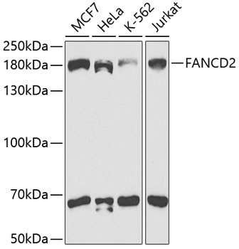 FANCD2 Rabbit Polyclonal Antibody
