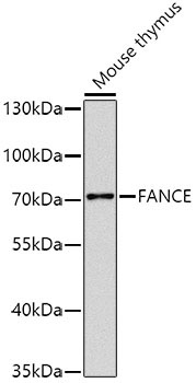 FANCE Rabbit Polyclonal Antibody