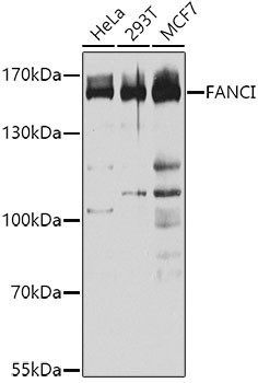 FANCI Rabbit Polyclonal Antibody