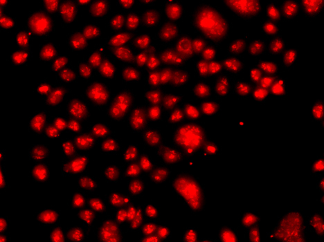 FANCM Rabbit Polyclonal Antibody