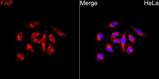 FAP Rabbit Polyclonal Antibody