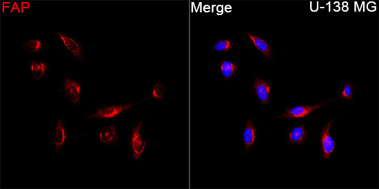 FAP Rabbit Polyclonal Antibody - Image 2