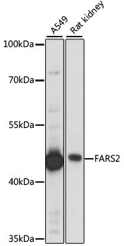 FARS2 Rabbit Polyclonal Antibody
