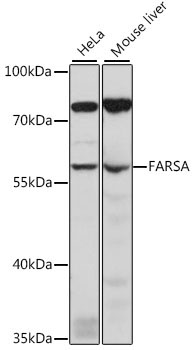 FARSA Rabbit Polyclonal Antibody