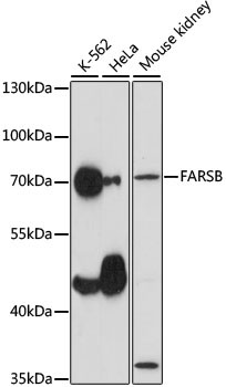 FARSB Rabbit Polyclonal Antibody
