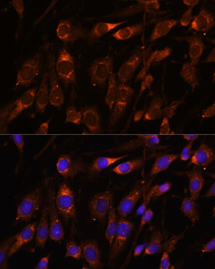 FARSB Rabbit Polyclonal Antibody - Image 2