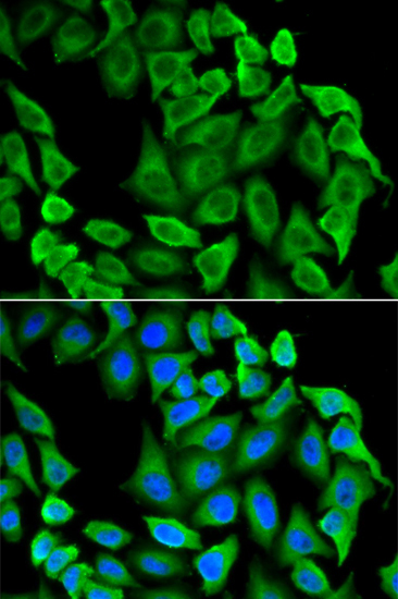 Fas Rabbit Polyclonal Antibody