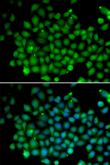 FAT10/UBD Rabbit Polyclonal Antibody