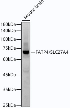 FATP4/SLC27A4 Rabbit Monoclonal Antibody