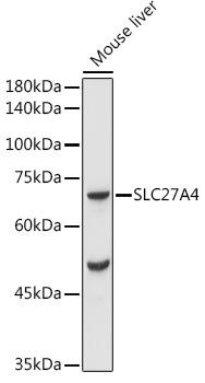 FATP4/SLC27A4 Rabbit Polyclonal Antibody