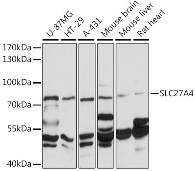 FATP4/SLC27A4 Rabbit Polyclonal Antibody