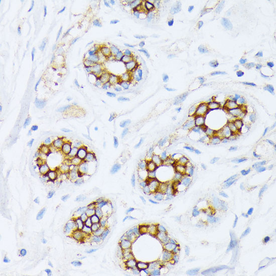 Fatty Acid Synthase (FASN) Rabbit Polyclonal Antibody - Image 8