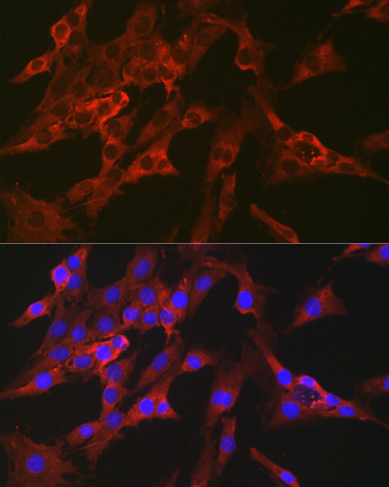FBP1 Rabbit Polyclonal Antibody - Image 2