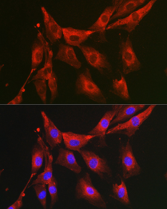 FBP1 Rabbit Polyclonal Antibody - Image 3