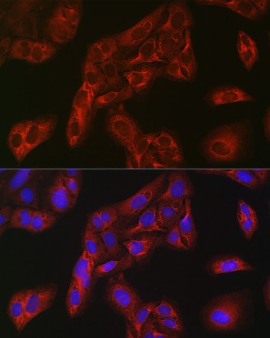 FBP1 Rabbit Polyclonal Antibody - Image 4