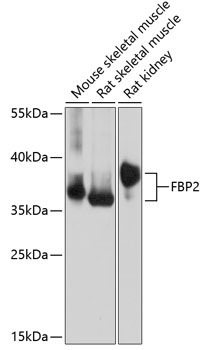 FBP2 Rabbit Polyclonal Antibody