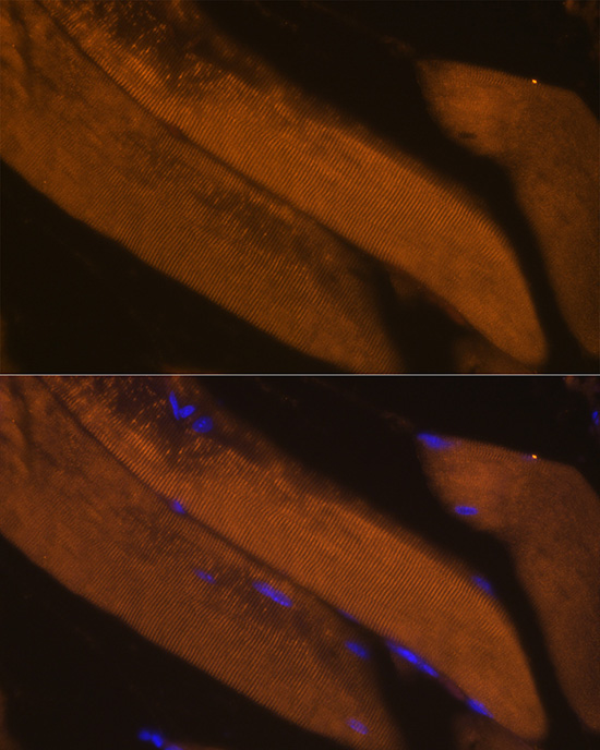 FBP2 Rabbit Polyclonal Antibody - Image 2