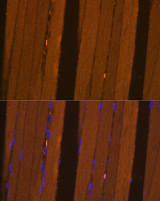 FBP2 Rabbit Polyclonal Antibody - Image 3