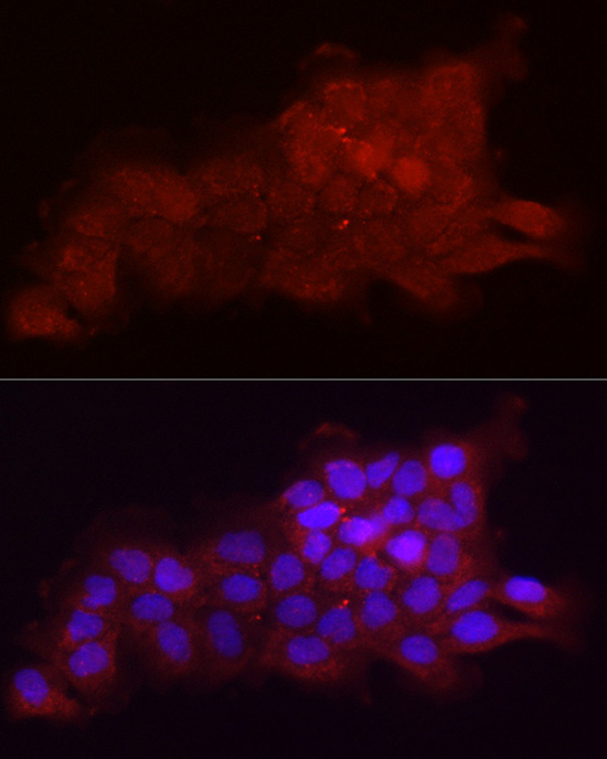 Fbx32/FBXO32 Rabbit Polyclonal Antibody