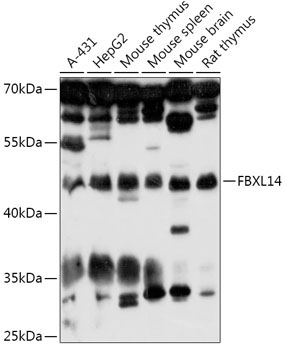 FBXL14 Rabbit Polyclonal Antibody