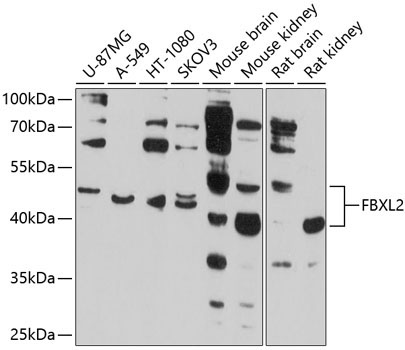 FBXL2 Rabbit Polyclonal Antibody