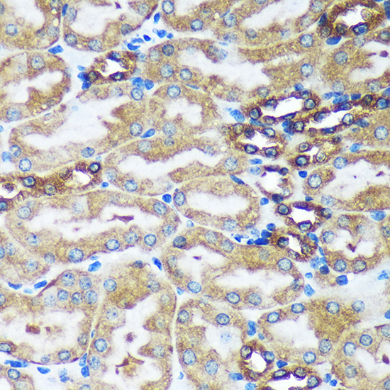 FBXO21 Rabbit Polyclonal Antibody - Image 2