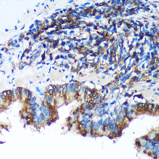 FBXO21 Rabbit Polyclonal Antibody - Image 3