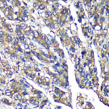 FBXO21 Rabbit Polyclonal Antibody - Image 4