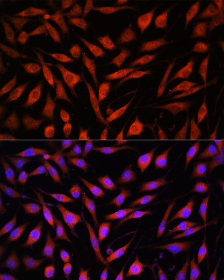 FBXO21 Rabbit Polyclonal Antibody - Image 5