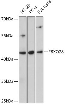 FBXO28 Rabbit Polyclonal Antibody