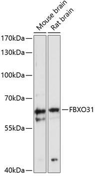 FBXO31 Rabbit Polyclonal Antibody