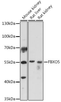 FBXO5 Rabbit Polyclonal Antibody