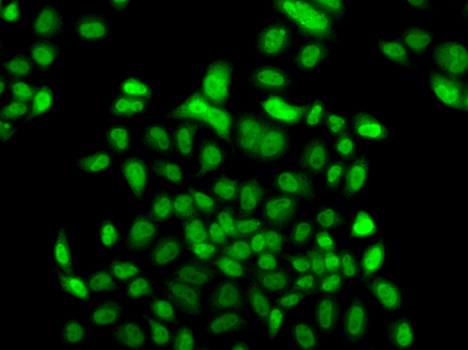 FBXO7 Rabbit Polyclonal Antibody - Image 2