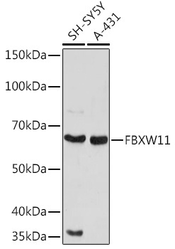 FBXW11 Rabbit Polyclonal Antibody