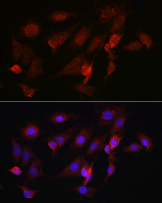 FBXW11 Rabbit Polyclonal Antibody - Image 2