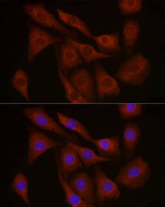 FBXW11 Rabbit Polyclonal Antibody - Image 3