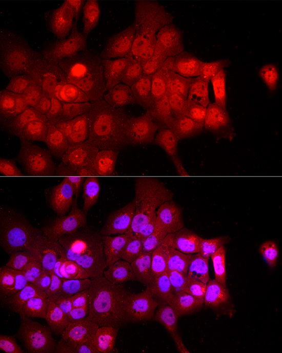 FBXW11 Rabbit Polyclonal Antibody - Image 2