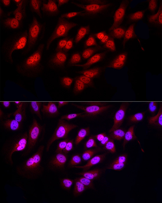 FBXW11 Rabbit Polyclonal Antibody - Image 3