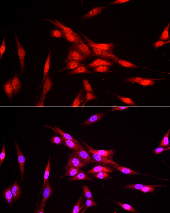 FBXW11 Rabbit Polyclonal Antibody - Image 4