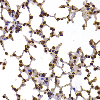 FBXW7 Rabbit Polyclonal Antibody - Image 2