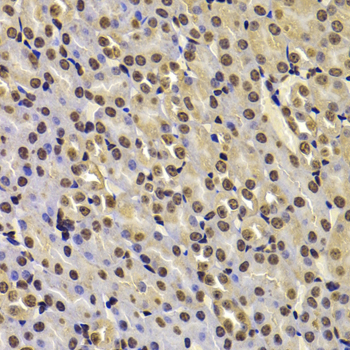 FBXW7 Rabbit Polyclonal Antibody - Image 3