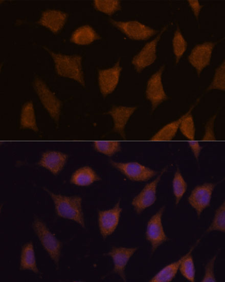 FBXW8 Rabbit Polyclonal Antibody - Image 2