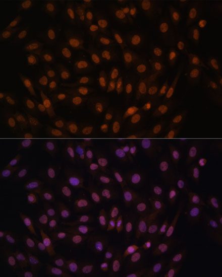 FCF1 Rabbit Polyclonal Antibody - Image 3